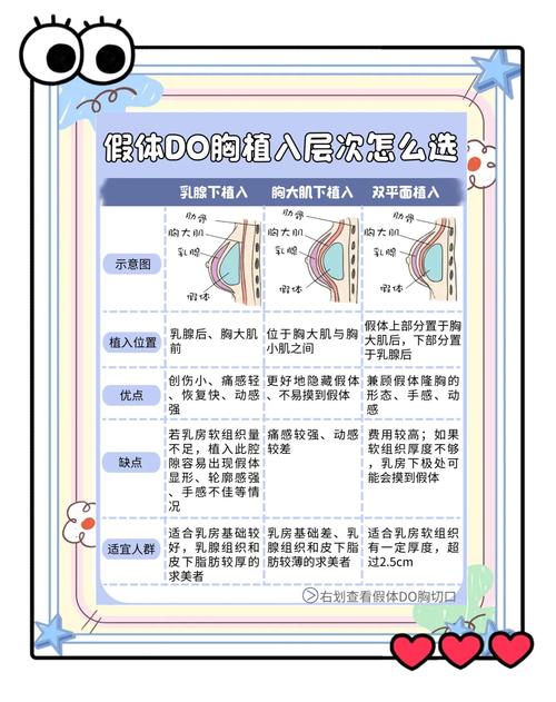 最安全的丰胸是假体还是脂肪填充