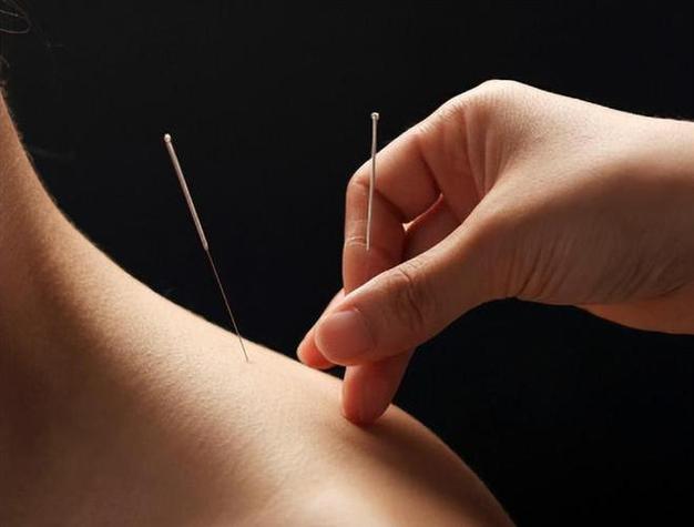 最新国家标准针灸穴位挂图