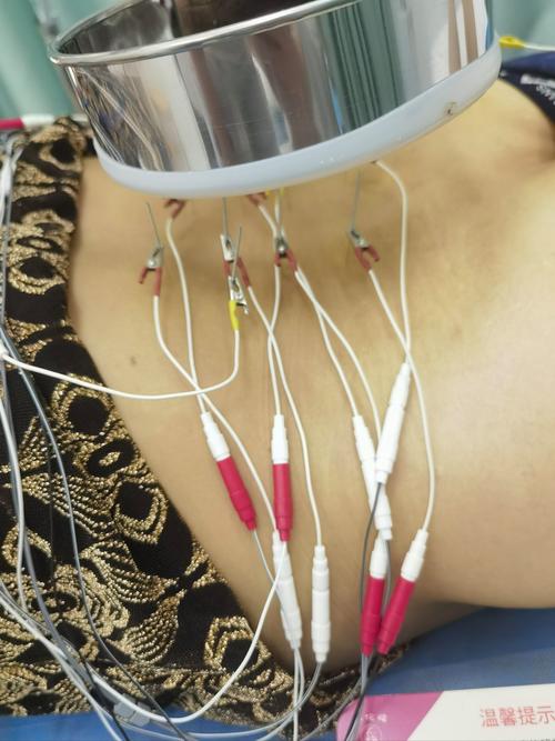 针灸能治疗腰椎间盘突出吗