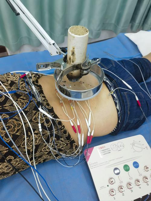 腰椎间盘突出针灸后更疼