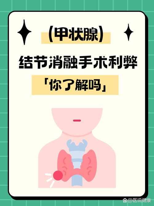 微创消融术治疗甲状腺结节安全吗