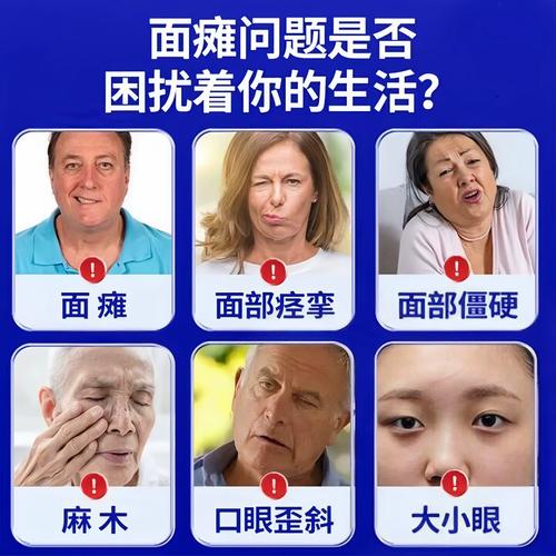 面瘫针灸好还是贴膏药好