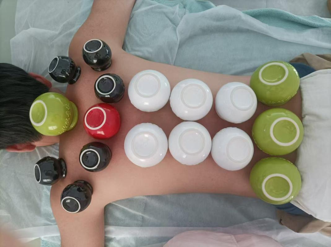 按摩 刮痧 拔罐和针灸