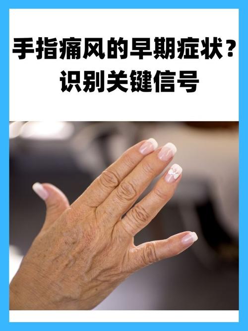 痛风一般手的哪个位置疼