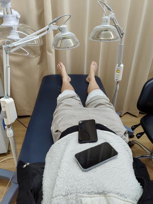 风湿性关节炎的针灸治疗