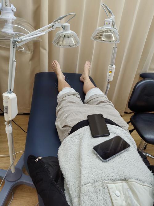 针灸可以治疗静脉曲张吗