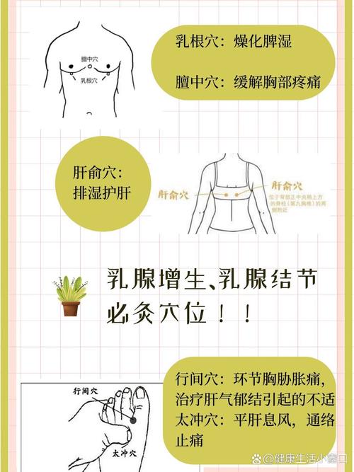 乳腺结节可以针灸治疗吗