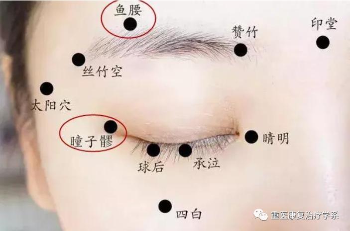 眼睑下垂针灸治疗方法