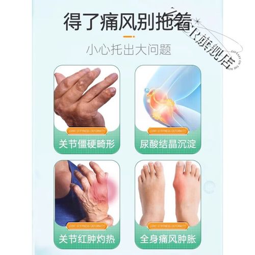 娜莎20痛风胶囊副作用