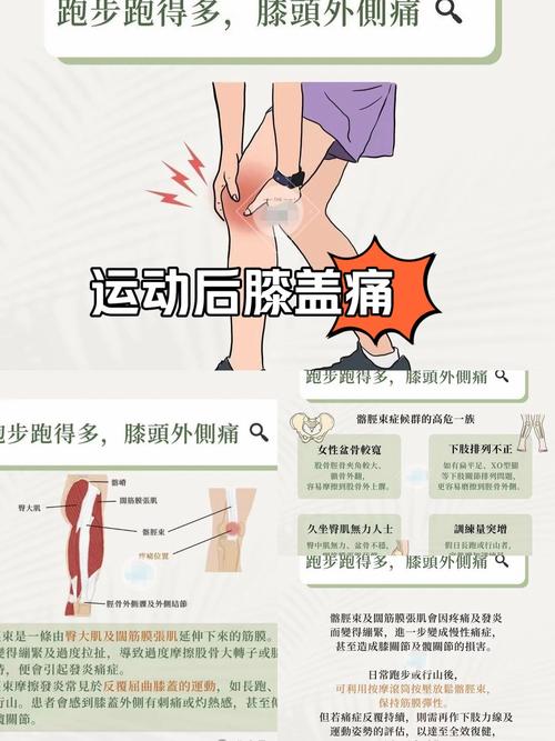 膝盖痛风怎么办快速止痛