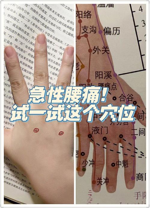 腰疼应该针灸什么部位