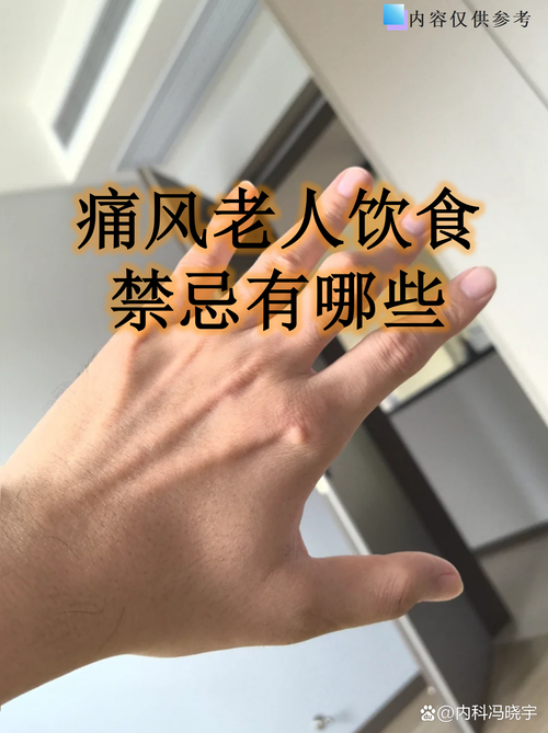 吃西芹籽7天后痛风复发