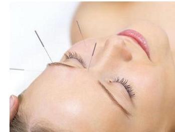 面部痉挛针灸多久会好