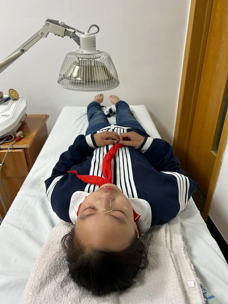 中医针灸治疗儿童近视
