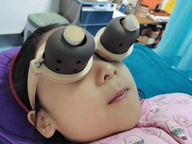 中医针灸治疗儿童近视