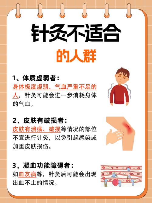 针灸治疗腰腿痛的配方