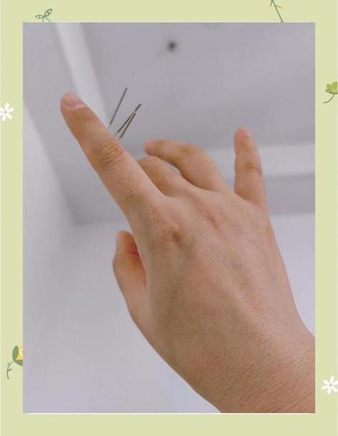 中医针灸治疗卵巢衰竭