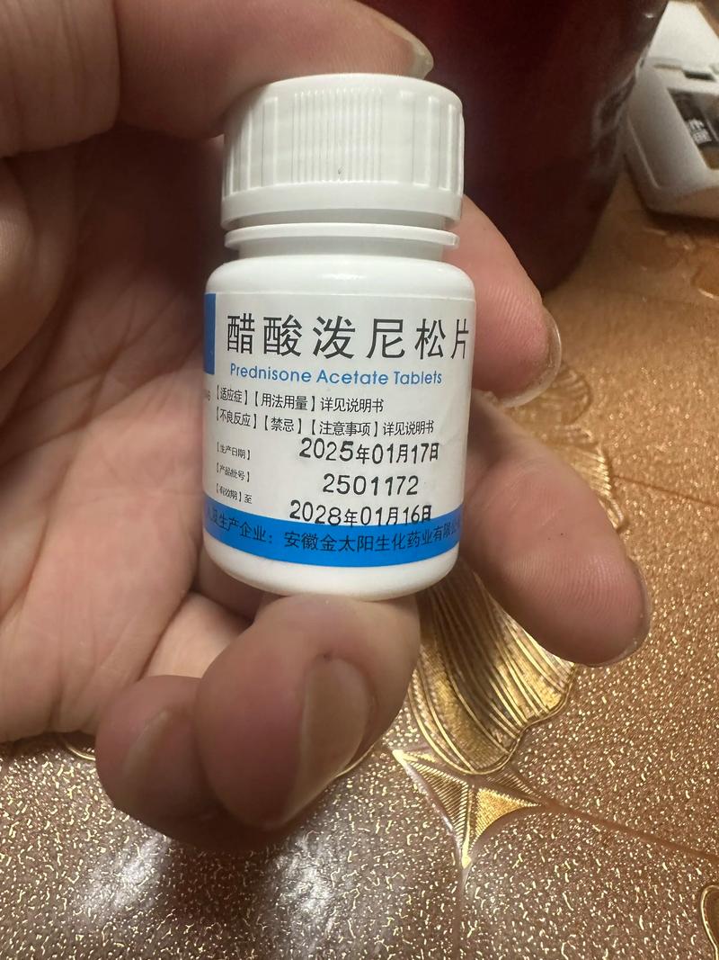 醋酸泼尼松片治疗痛风吗