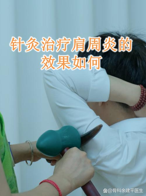 肩周炎推拿好还是针灸