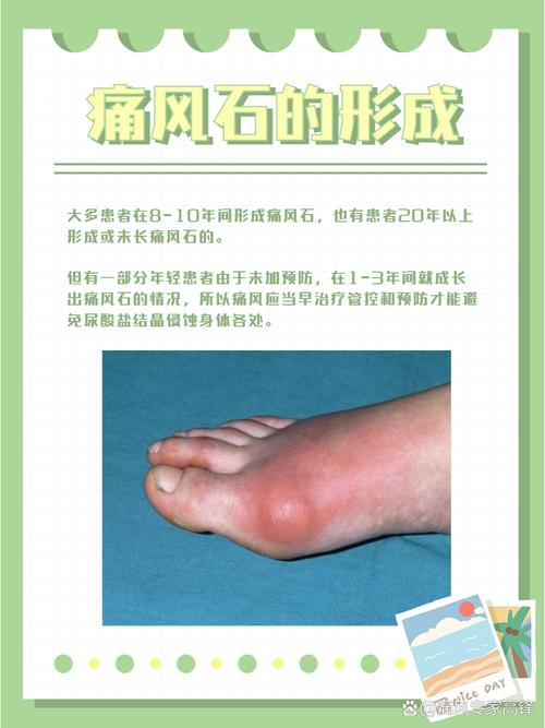 治疗痛风最好的医院排名