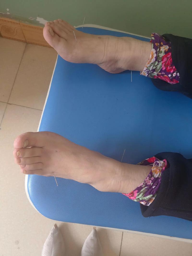 合肥中医推拿针灸在哪