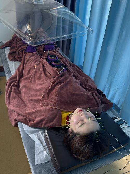 电子针灸可以治疗肾虚