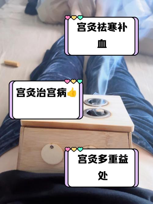 艾灸针灸治疗子宫肌瘤