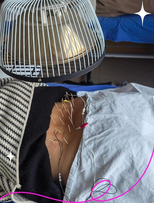 针灸治疗痛经效果怎样