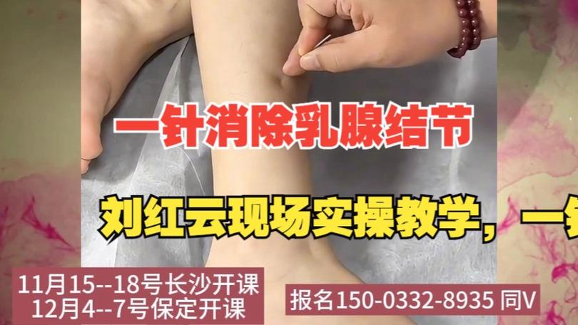 乳房针灸视频教学视频