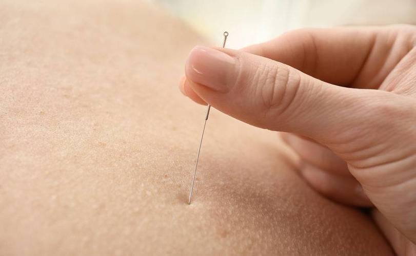 腹部减肥针灸视频下载