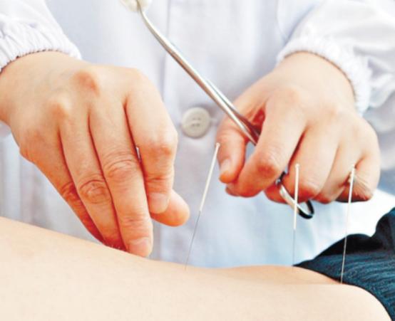 针灸促使卵泡发育生长