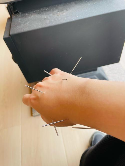 乌鲁木齐中医医院针灸