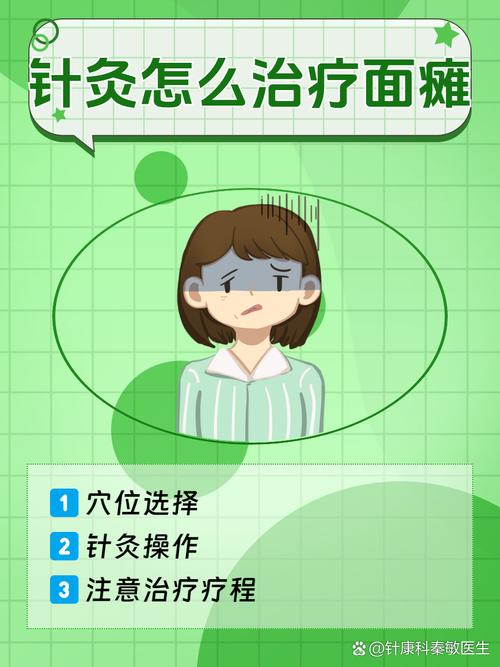 针灸治疗面瘫 pdf