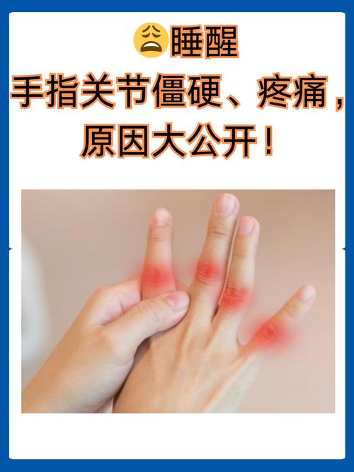 大拇指关节痛是痛风吗