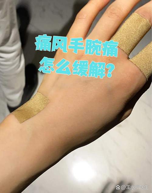 痛风能引起手腕子痛吗
