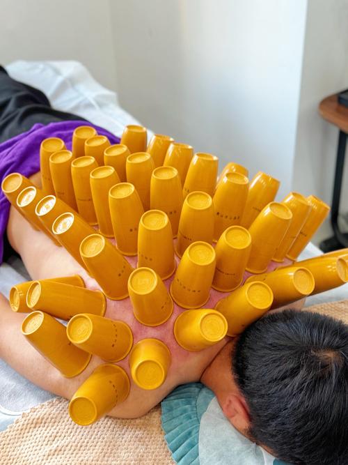 九针堂针灸治疗仪团购