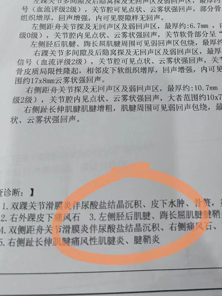 做一个痛风检查多少钱