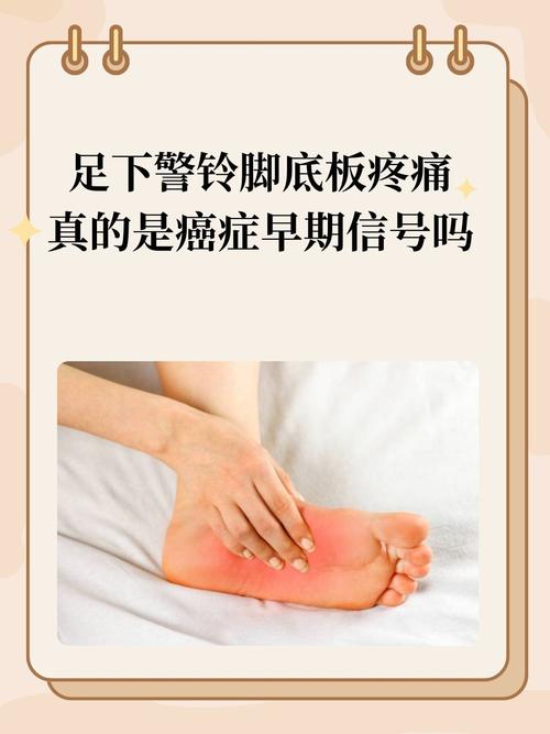 痛风会引起脚底板疼吗