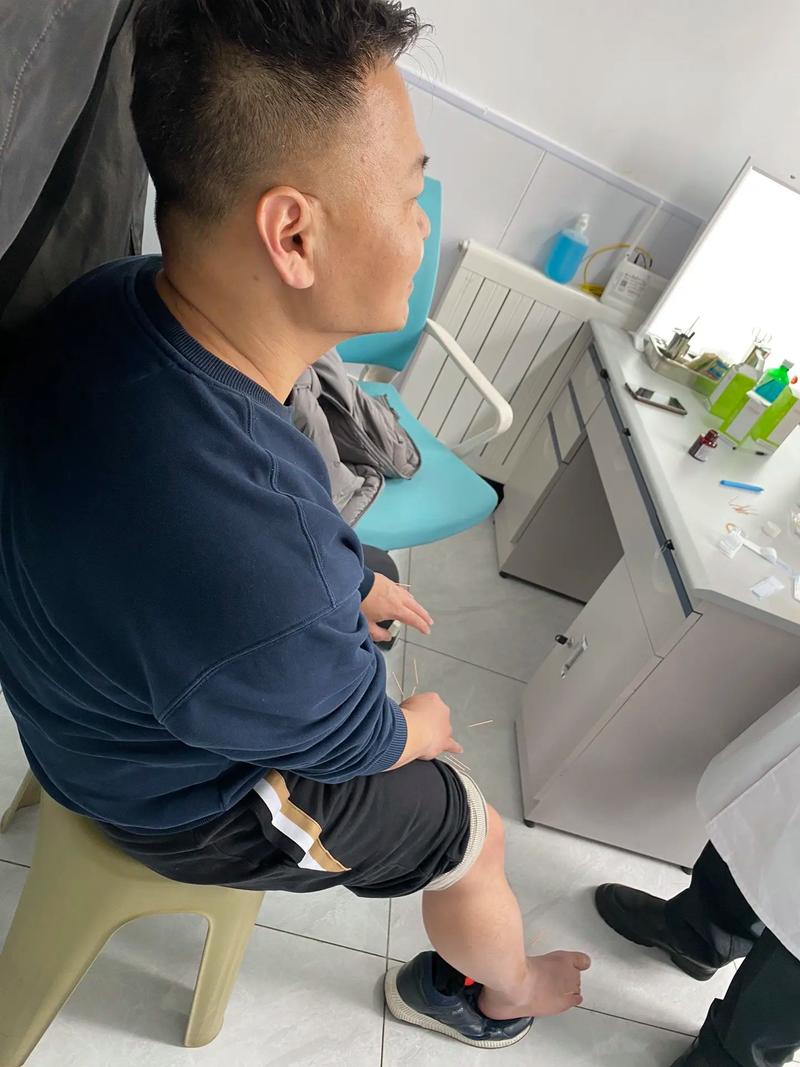 针灸能治过敏性紫癜吗