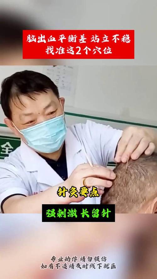 针灸对脑血管病的效果