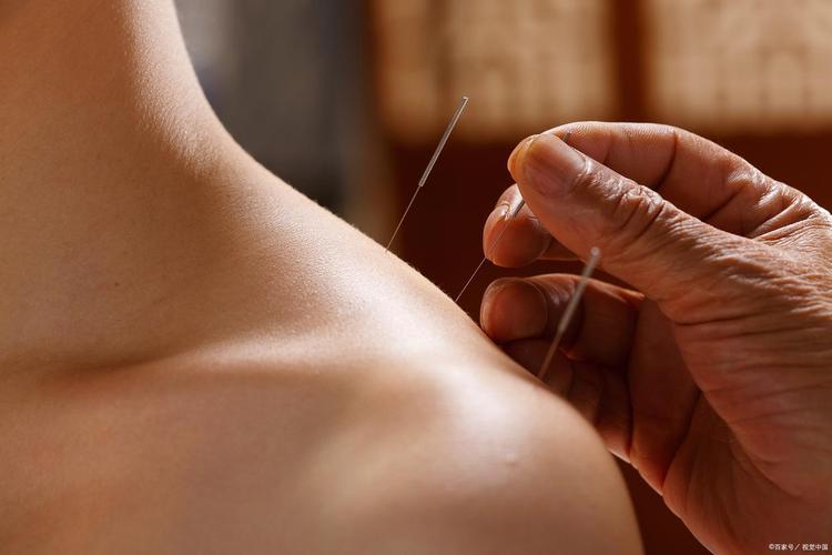 河北省中医院针灸减肥