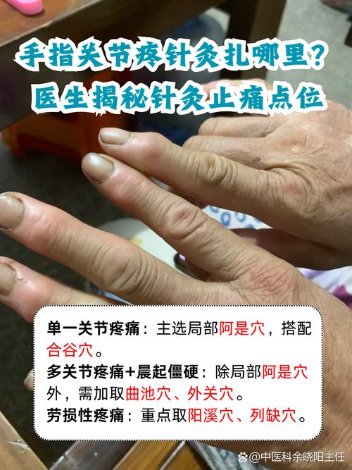 手指关节痛针灸管用吗