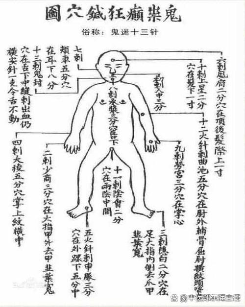 针灸对精神分裂有用吗