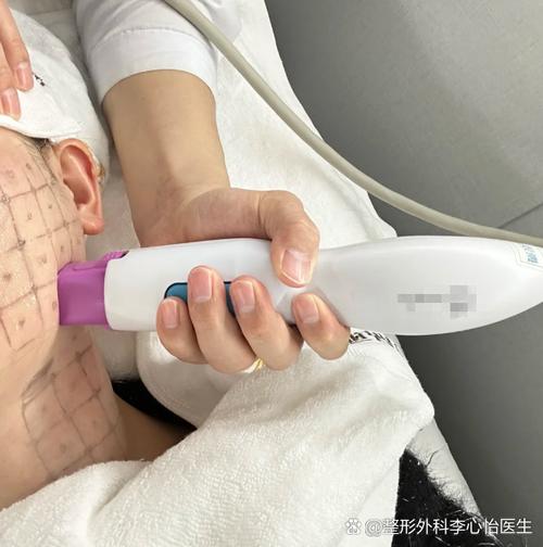 目前最安全的面部提升手术