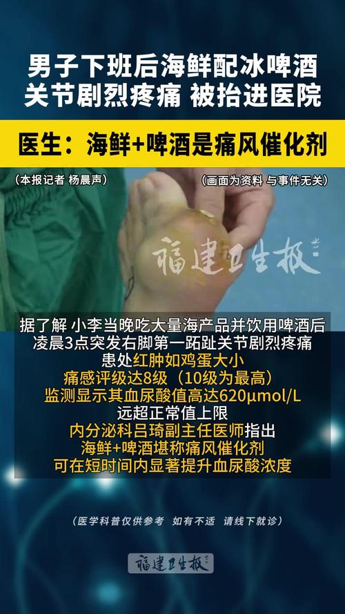 痛风病人可以喝果啤吗