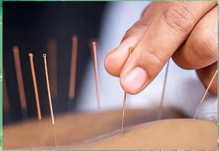 腰椎间盘突出针灸疗法