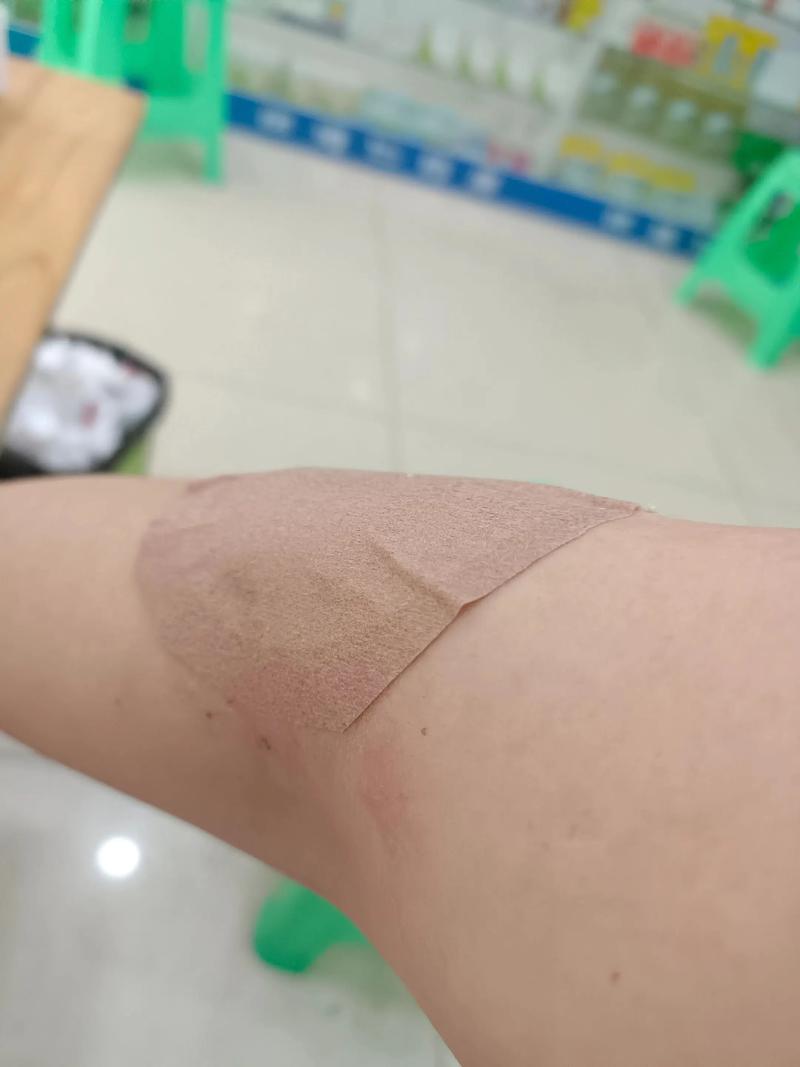 针灸能治风湿关节炎吗