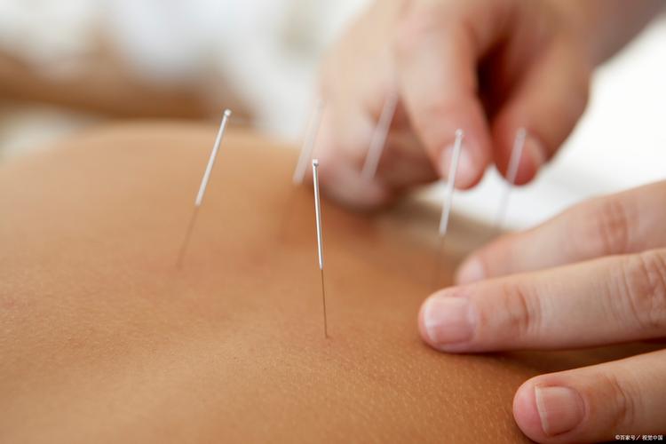 瘦针灸减肥效果怎么样