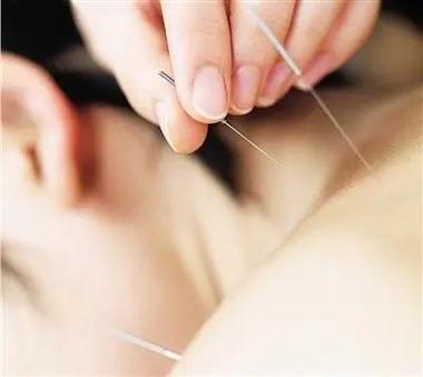 瘦针灸减肥效果怎么样