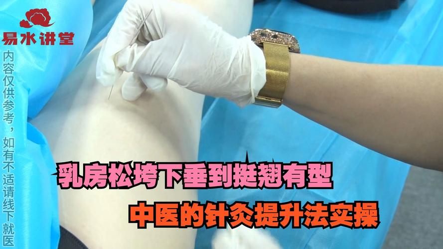 产后两个月可以针灸吗